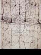 El canto de las neuronas. Música y neurología                                                              